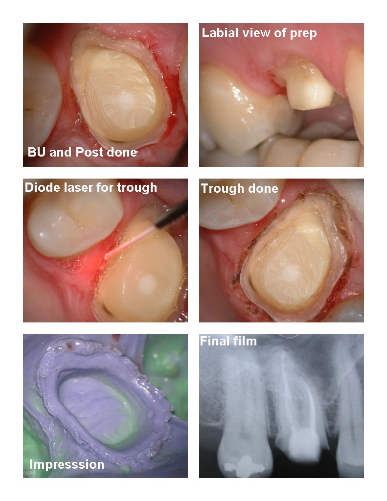 Endo first molar pg 6.jpg